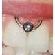 Lippenbändchenpiercing