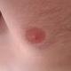 komische " nippel "