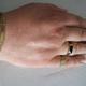 Armband mit 2 Ringen