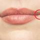 verändern sich durch rauchen die lippen oder backen?