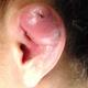 Ich will meinen Helix selber stechen