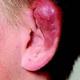 Ich will meinen Helix selber stechen
