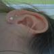Knorpelpiercing extrem angeschwollen !! O.o