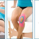 Knie Probleme,was tun?