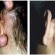 Brauche DRINGENDE Hilfe beim wildfleischwuchs und einer leichten entzündung vom Tragus Piercing!!!!!