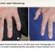 selbstgestochene tatto entfernen