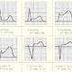 EKG? weiß jmd antwort