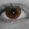 2 Augenfarben in einem Auge?