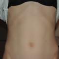 Alle Muskeln am Bauch beim Sport beansprucht?