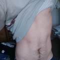 An alle weiblichen Gottesgeschöpfe - findet ihr Haare auf dem Bauch schlimm ?