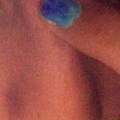 nase