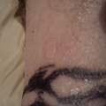 Blase über tattoo