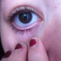 Brauner , kleiner fleck im Auge???:(