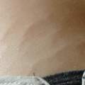 Dehnungsstreifen mit 16 ?! Wo kommen sie her