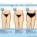 dünner werden,brauche tipps ^^ dringend hilfe gesucht!!