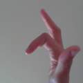 Finger gebrochen/ verstaucht? Erfahrungsberichte?