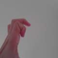 Finger gebrochen/ verstaucht? Erfahrungsberichte?