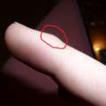 Finger verletzt :O