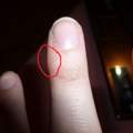 Finger verletzt :O