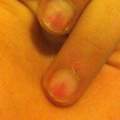 Fingernägeln ://