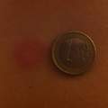 Große rote, juckende Stiche. Was könnte das sein ?