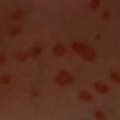 Hautausschlag ? Virus ? Infektion ? Hilft mir bitte