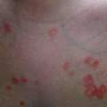 Hautausschlag ? Virus ? Infektion ? Hilft mir bitte