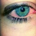 ich habe oft rote augen, ohne zu kiffen