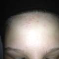 Ich schwitze selten und wasche meine Haare jeden Tag.. Aber, was ist DAS?? (Bilder)