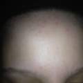 Ich schwitze selten und wasche meine Haare jeden Tag.. Aber, was ist DAS?? (Bilder)