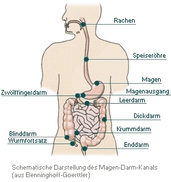 verwachsungen im darm ursachen