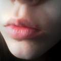 Kann das Blaeschen auf meiner Lippe Herpes sein?