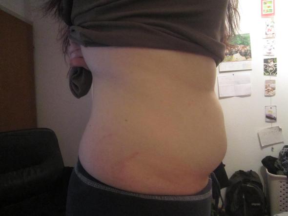 20 Tage 15 kg abzumagern