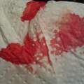 Passt diese Farbe meines Blutes ?