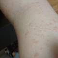 Arm