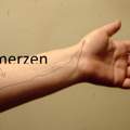 Schmerzen im Unterarm. :/