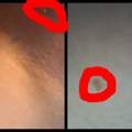 So ein komisches Ding unter der Achsel was ist es?