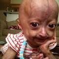 Spenden für Adalia Rose :) !