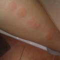 Stiche identifizieren?