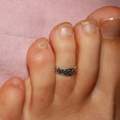Was ist da mit meinen Zehennägeln los? Nagelpilz, Durchblutungsstörung oder etwas ganz Anderes?