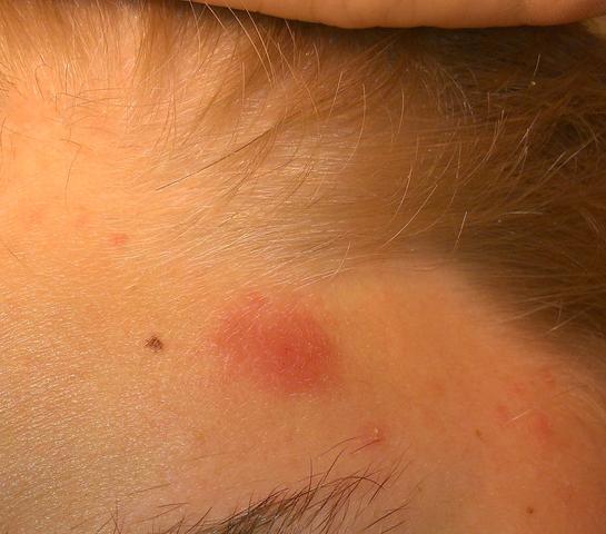Witeks otbeliwajuschtschaja die Maske für die Person gegen die Sommersprossen und die Pigmentflecke