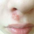 Was ist das? Was kann ich tun