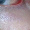 Was kann das in meinem Auge sein?