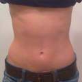 Wie findet ihr meinen Bauch? Tipps zum Zunehmen