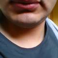 wieso habe ich als Junge/Mann volle Lippen
