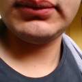 wieso habe ich als Junge/Mann volle Lippen