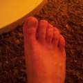 Zehenproblem !! » Ahnungslosigkeit.. aber im Angriff :)