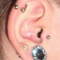 Zersplitterter Knorpel nach Piercingstechen.