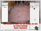 Pickelprobleme.?! So bekommst du sie leicht mit Gimp weg...