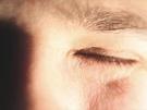 Augen von Fremdkörpern befreien